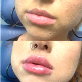 New-KYSSE-Lips